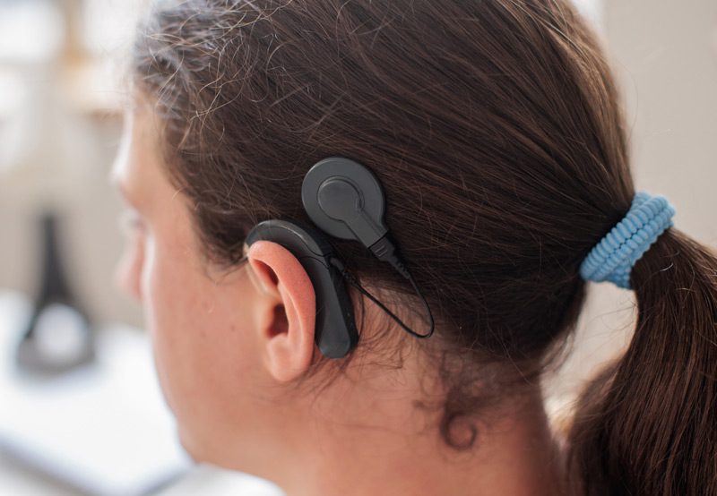 Cochlear-implant-processor-behind-ear