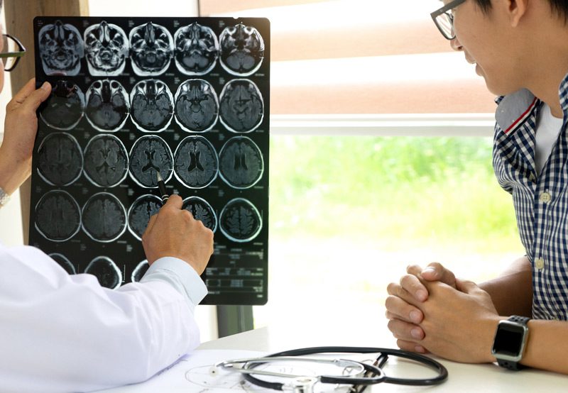 Doctor-explaining-brain-MRI-results-to-patient Doctor-explaining-brain-MRI-results-to-patient
