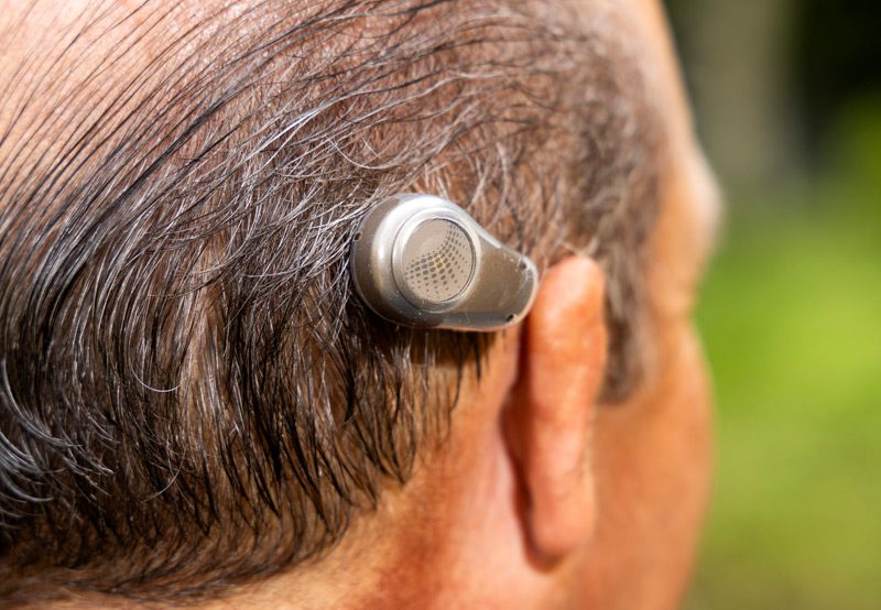 Man-with-bone-anchored-hearing-aid